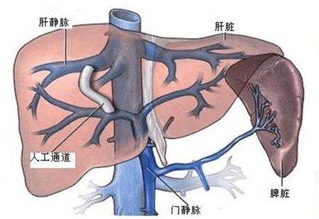 胃冠状静脉解剖图图片