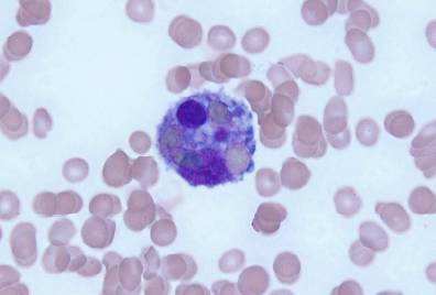 噬血细胞综合征