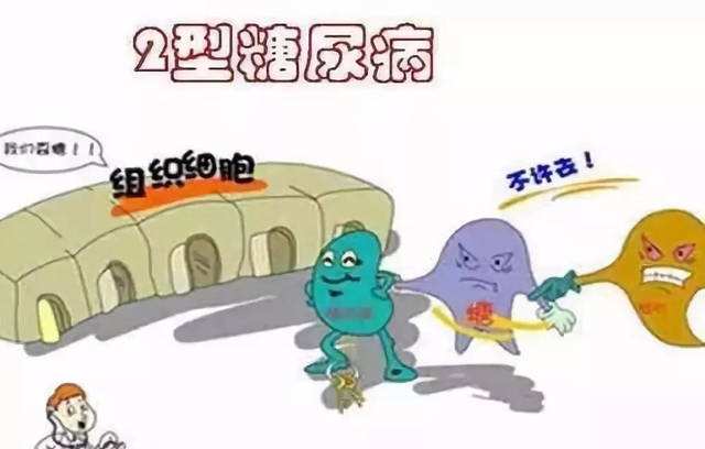 2型糖尿病