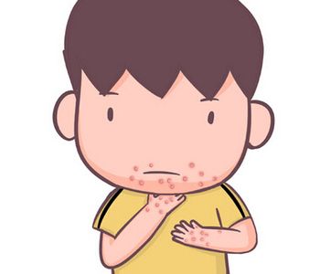 幼年型皮肌炎