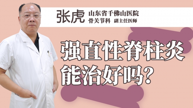 强直性脊柱炎能治好吗？